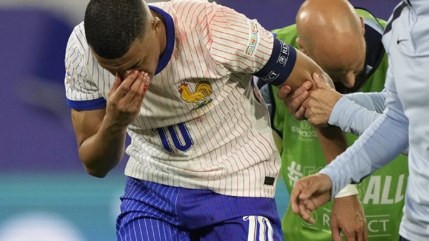 Mbappe's facial injury places doubt on his continued involvement in Euro 2024