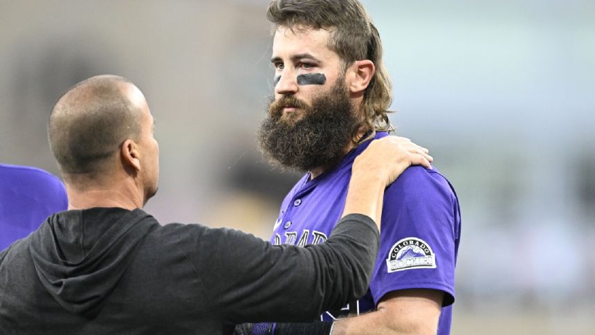 Rockies DH Blackmon leaves game vs. Padres after getting hit on left arm, left eye by errant throw